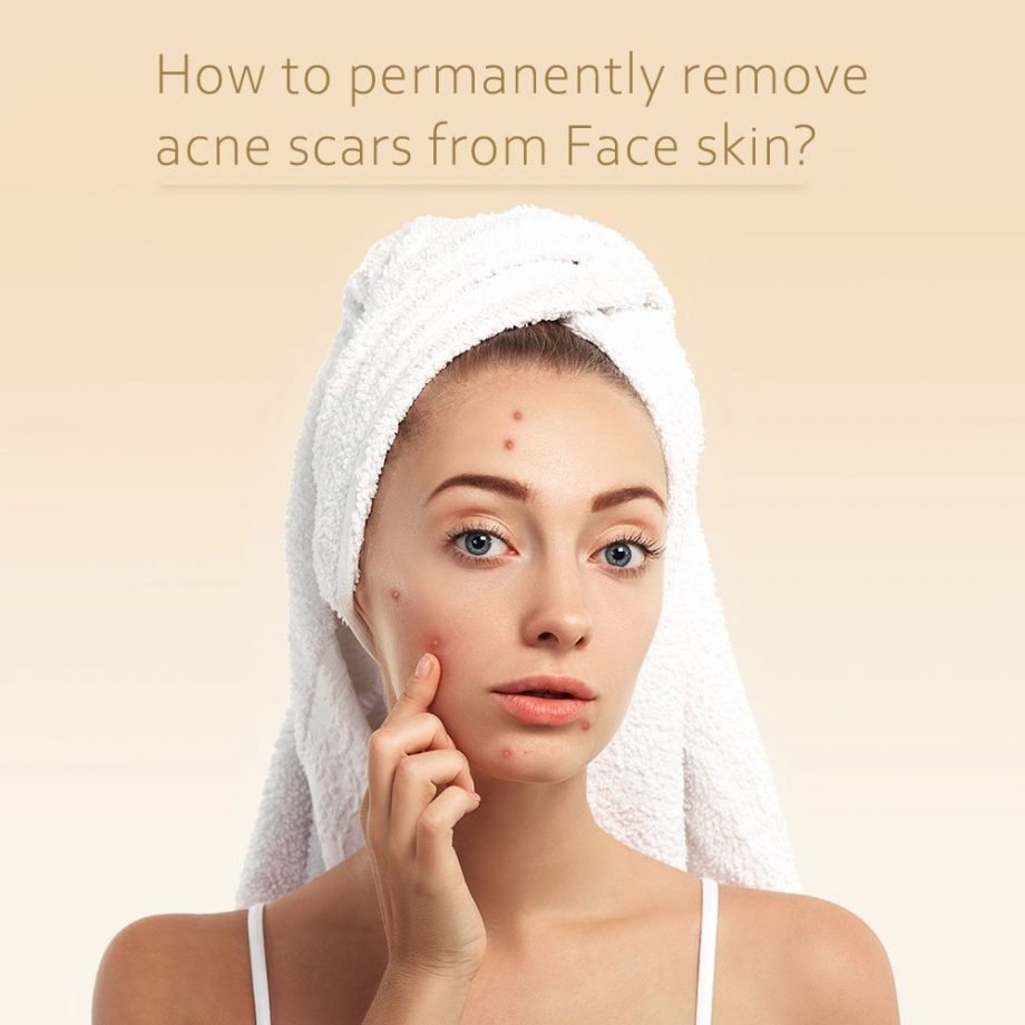 How to Permanently Remove Acne Scars from Face Skin?